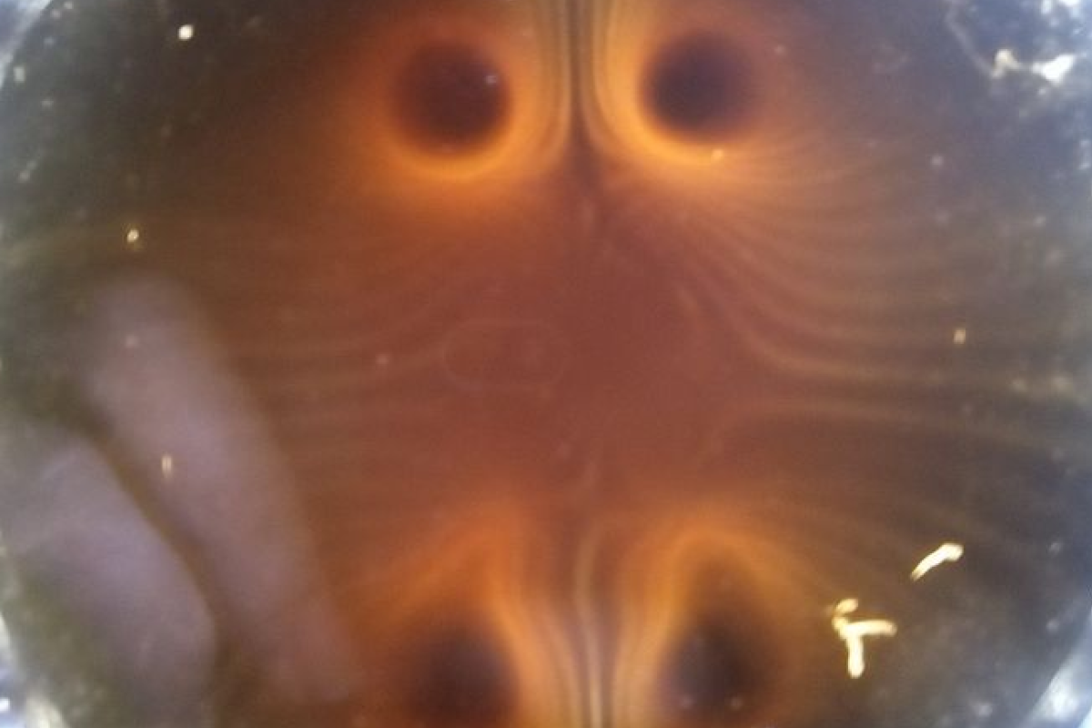Should I Be Worried About EMF Exposure?