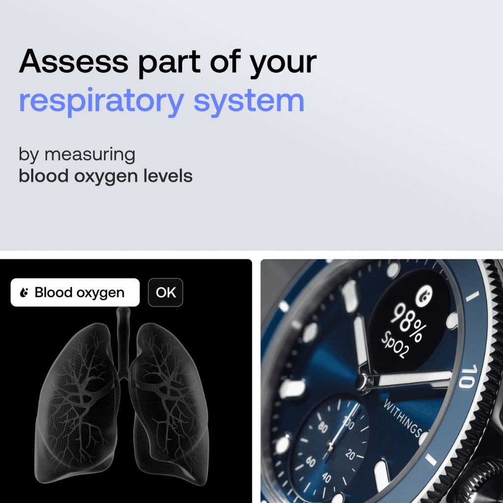 ScanWatch Nova - Blue - Image 4